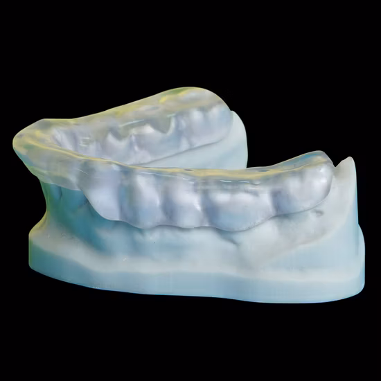 Coroas dentárias de laboratório dentário da China com prótese Rpd