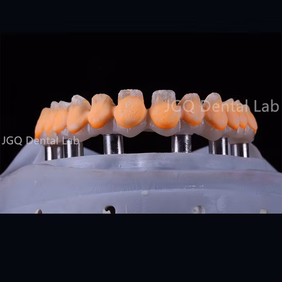 Coroa e ponte de zircônia para laboratório dentário de ponte de implante fabricadas na China